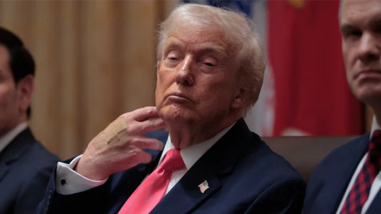 House Explains Bandages on Trump's Hand Amid Health Scrutiny