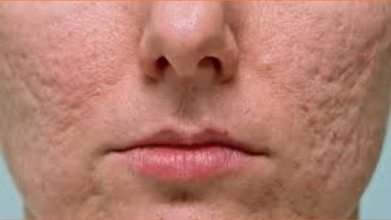 The Scars of January: A Region Transformed